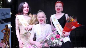 Factsheet: International Albinism Awareness Day – dispel the myths with facts