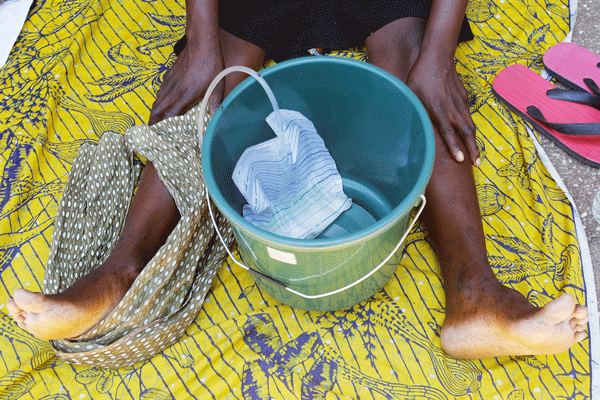 Not a lifetime sentence: obstetric fistula is reversible